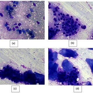 A B C D Mature Squamous Cells Can Be Seen In Cytology Smears Against A