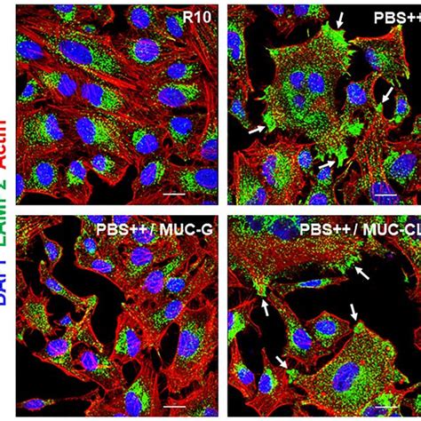 Inhibition Of PBS Induced Lysosome Spreading By MUC G HeLa Cells