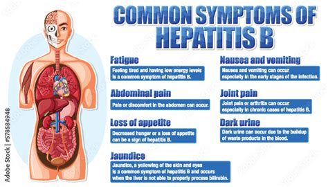 Informative poster of common symptoms Hepatitis B Stock Vector | Adobe ...