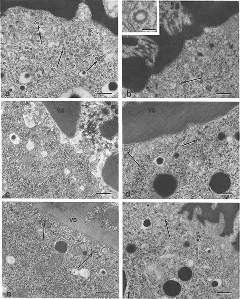 Transmission Electron Microscopy Showing The Presence Or Near Absence