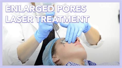 Enlarged Pores Laser Treatment - Oasis Medical Aesthetics