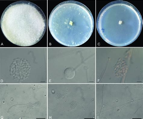 Colony Morphology Of Linnemannia Mannui Grown On Different Media