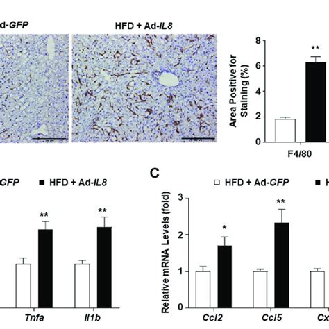 Il Overexpression Enhances Hepatic Inflammation In The Livers Of