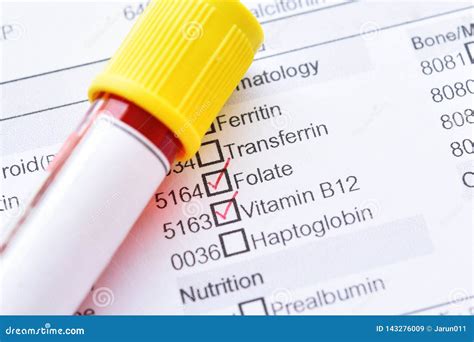 Blood Sample for Vitamin B12 and Folate Test Stock Image - Image of anemia, malnutrition: 143276009