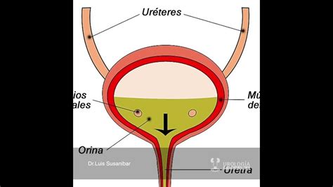 La Diabetes Produce Impotencia Sexual Youtube