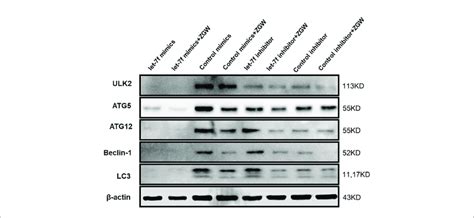 Changes In Autophagy Related Protein Expressions Ulk Atg Atg