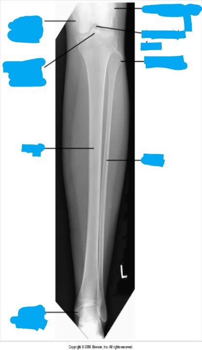 IMAGE EVAL AP TIB FIB EXAM 4 Diagram Quizlet