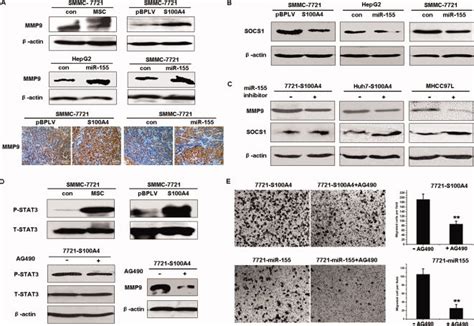 The S100A4 MiR 155 SOCS1 STAT3 MMP9 Axis Modulates HCC Invasion A