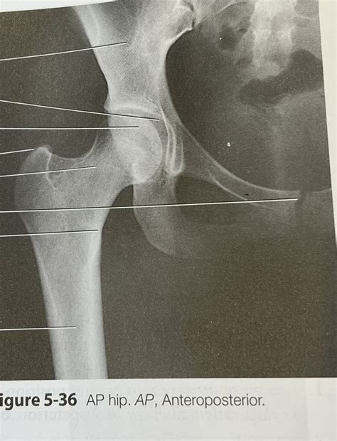 label ap hip diagram quizlet