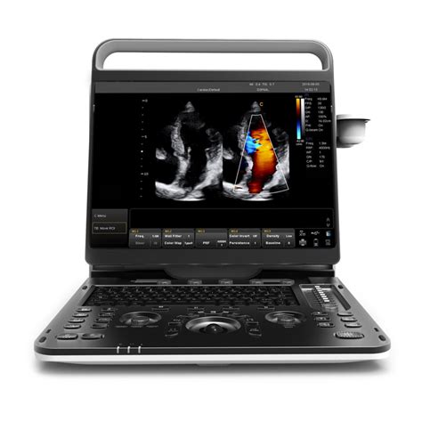 D D Trolley Color Doppler Ultrasound Cardiac Vascular Echo Msk Usg