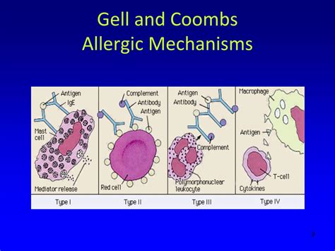 Ppt Pediatric Board Review Allergy Immunology Powerpoint