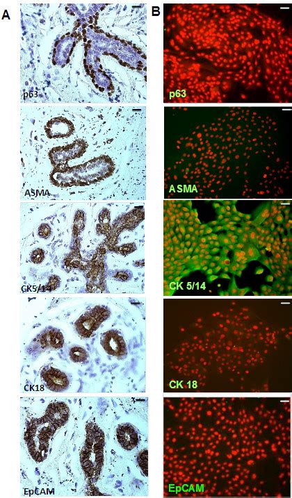 Characterization Of Primary Human Mammary Epithelial Cells