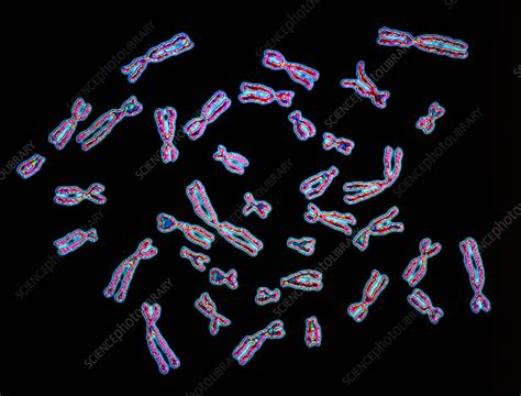 Human chromosomes - Stock Image - P656/0197 - Science Photo Library