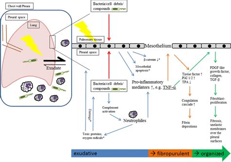 Phases And Natural Progression Of Pleural Empyema Adopted From 15