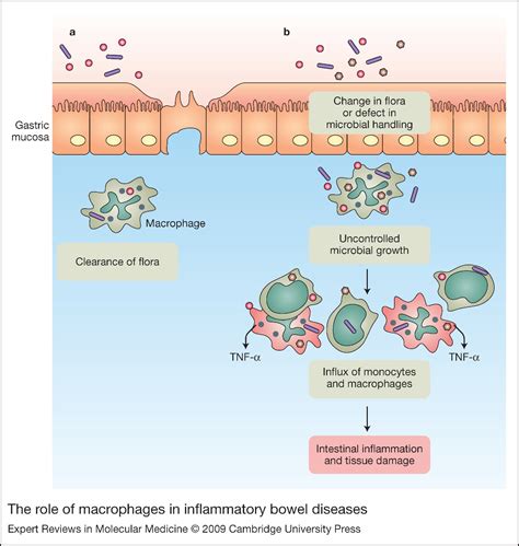 The Role Of Macrophages In Inflammatory Bowel Diseases Expert Reviews