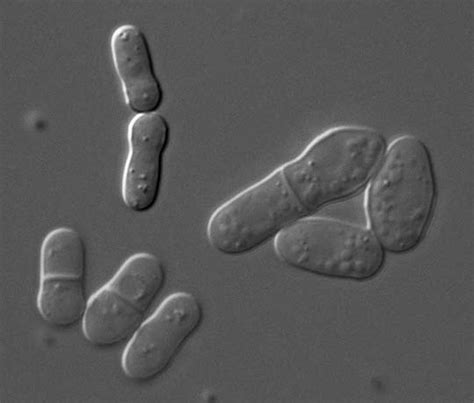 Mysteries Of The Fission Yeast Genome Bubble To The Surface Broad