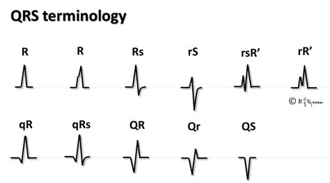 Ecg Interpretation Characteristics Of The Normal Ecg Off