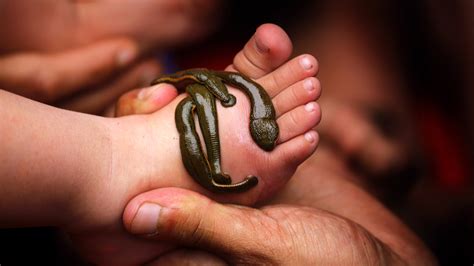 Leeches Are Making A Slimy Comeback In Modern Medicine Mashable