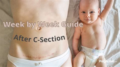 C Section Recovery Week By Week Guide