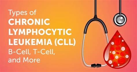 Types Of Chronic Lymphocytic Leukemia Cll B Cell T Cell And More