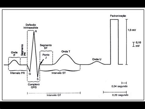 Aprenda A Ler Um Eletrocardiograma Ecg Youtube