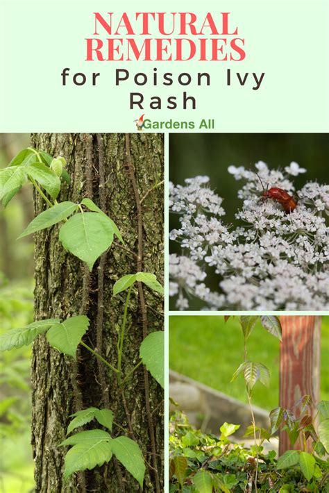 Natural Remedies For Poison Ivy Rash Gardensall Remedies