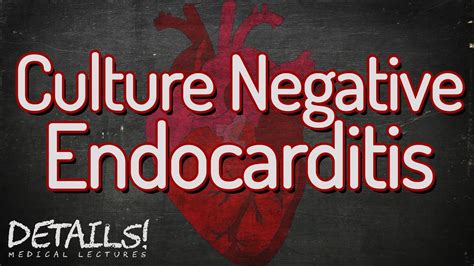 Causes Of Culture Negative Endocarditis Details Youtube