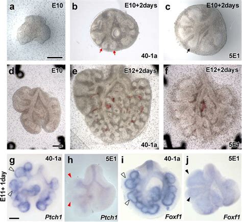 Alteration Of Lung Branching Morphogenesis And Gene Expression After