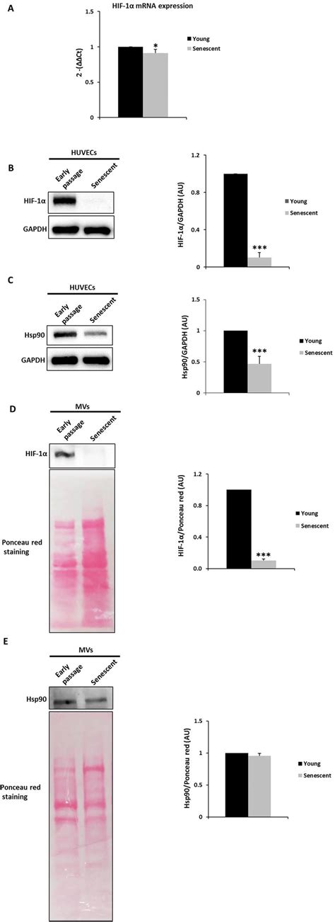 HIF 1α mRNA and HIF 1α and Hsp90 protein levels in HUVECs A qPCR