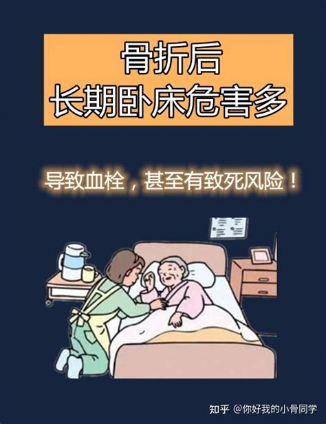 【骨折长期卧床的并发症】骨折后应该躺着别动？ 知乎