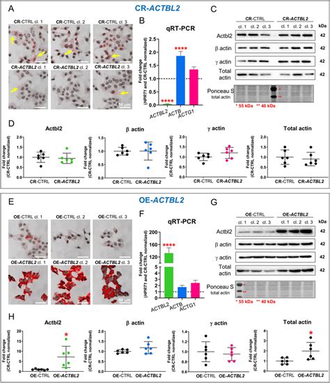 Successful Knockout Of Actbl2 And Overexpression Of Actbl2 In A375 Download Scientific Diagram