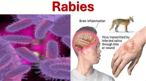 What Is Rabies Cause Symptoms Treatment And Prevention Of Rabies Youtube