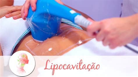 Lipocavita O Tratamento Est Tico Reduz Gordura Localizada Youtube