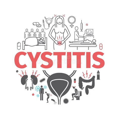 Cystitis Banner. Symptoms, Treatment. Vector Signs for Web Graphics. Stock Vector - Illustration ...