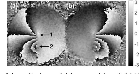 Figure 3 From Real Time Dual Sensitive Shearography For Simultaneous In Plane And Out Of Plane