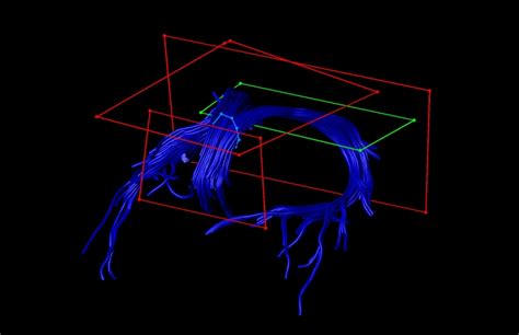 How we discovered that brain connections shape memories - EconoTimes