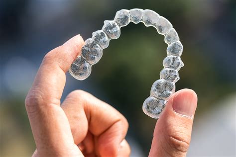 Những điều Cần Biết Về Niềng Răng Trong Suốt Invisalign