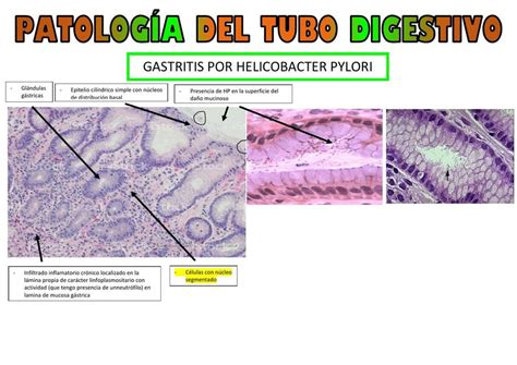 Patolog A Del Tubo Digestivo Diana Albornoz Udocz