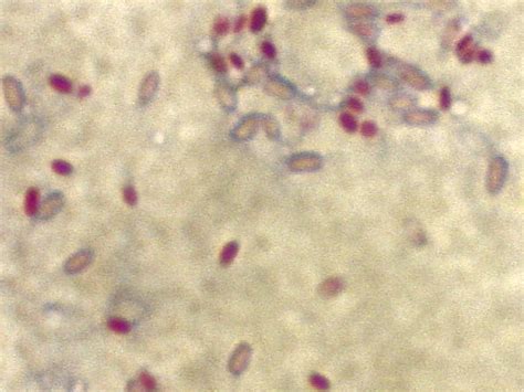 Mycobacterium smegmatis - wikidoc