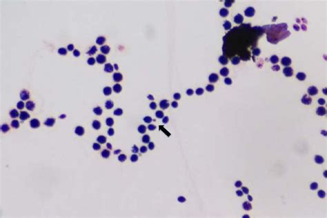 Fusarium Gram Stain