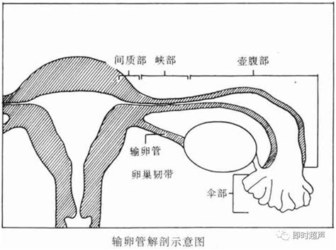 输卵管炎性疾病超声诊断卵巢