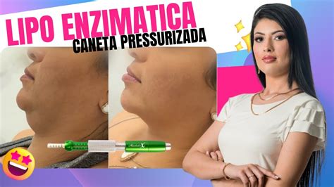 Lipo enzimática de papada sem agulhas caneta pressurizada YouTube