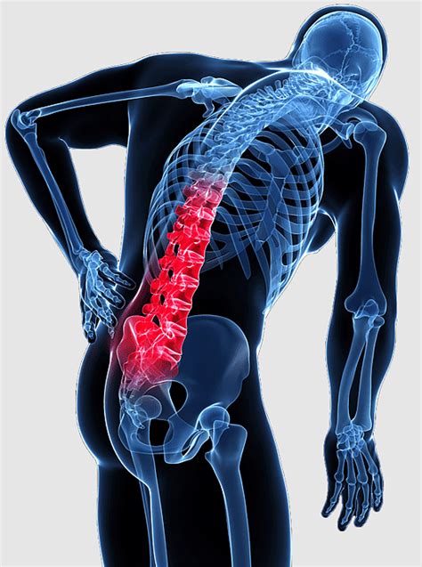 Sacroiliac Joint Nerve Pain