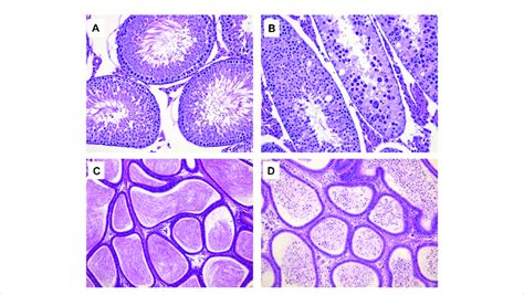 Hematoxylin And Eosin Stained Histologic Sections For Testis × 200