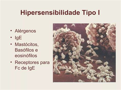 Hipersensibilidade O Que é 7