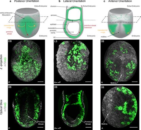 Figures And Data In Distinct Mesoderm Migration Phenotypes In Extra