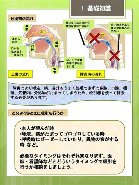 気管切開吸引パンフレット ｜ 国立長寿医療研究センター