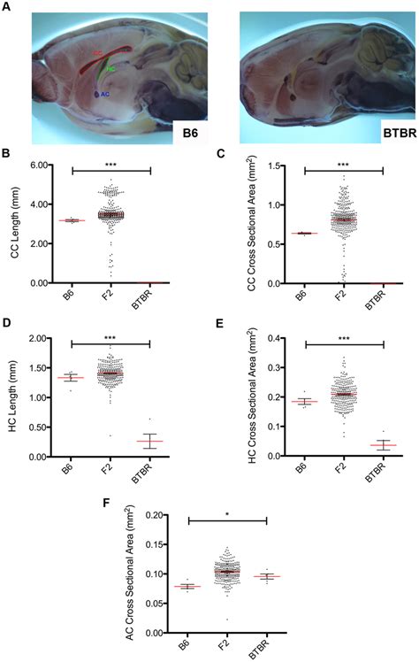 Callosal Phenotype Of The BTBR T Tf J Mouse A As Compared To The