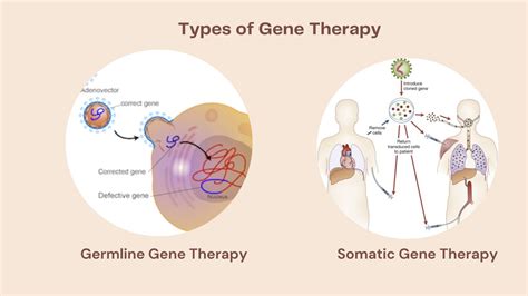 Gene Therapy And How Does It Work Types Procedure Medsurge India