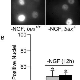 Nuclei In NGF Deprived Cells Accumulated Phospho C Jun Ser 63